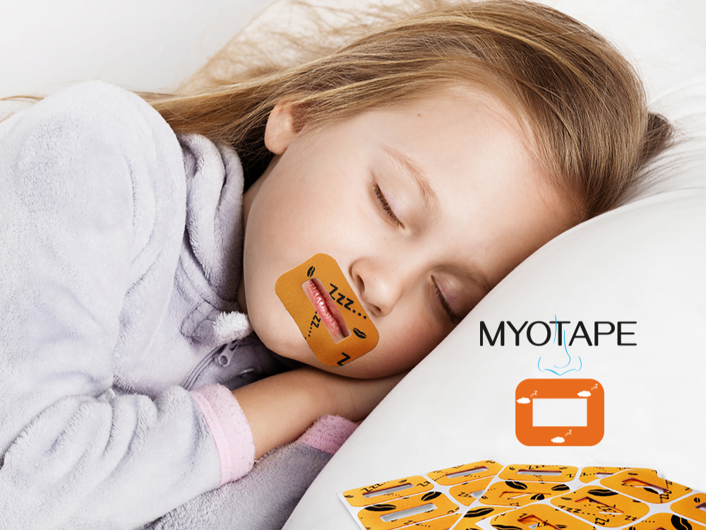 myotape review